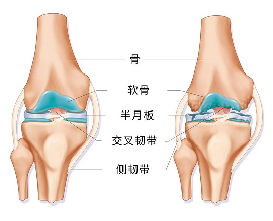 干细胞治疗骨质疏松